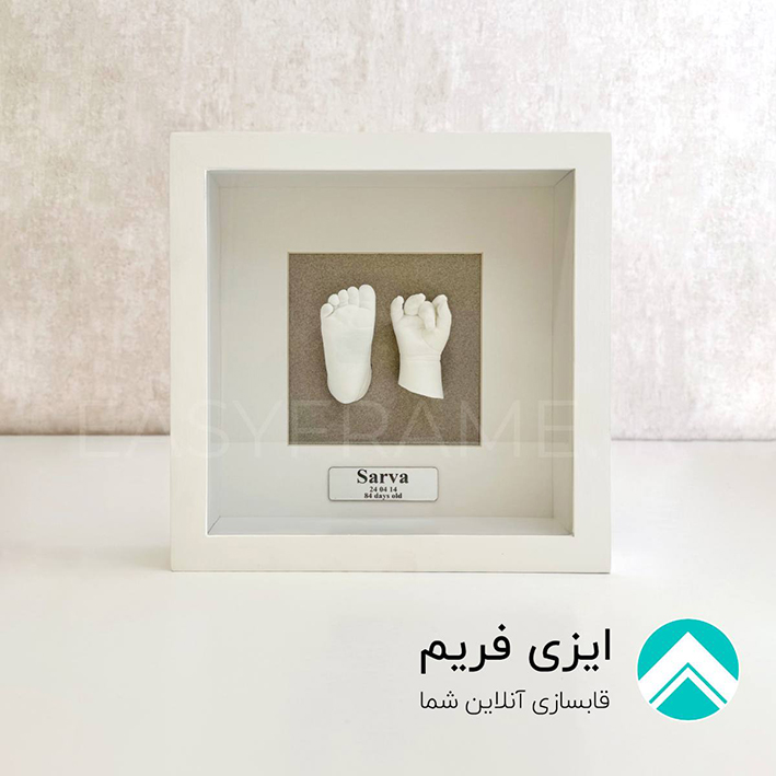 تندیس دست و پای نوزاد